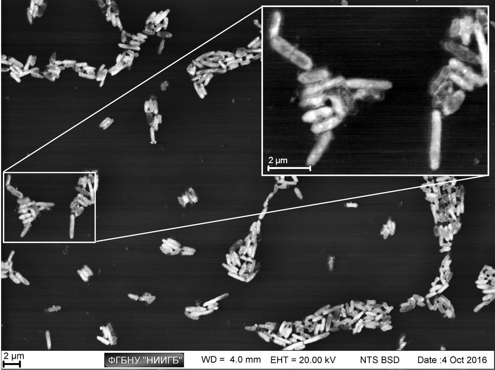 Klebsiella pneumoniae colony on laboratory plastic:
the differences in cell metabolic activity are visible (BioREE-B set, SEM image, BSE mode)