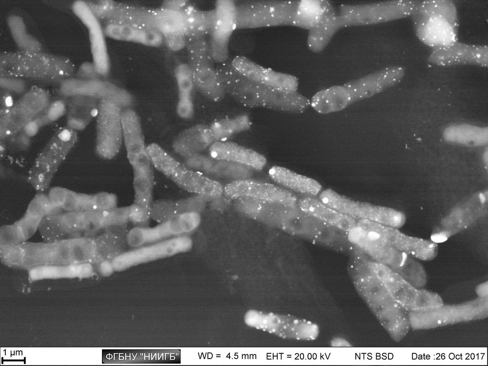 Bacillus cereus colony on laboratory plastic: the differences in metabolic activity of various size cells are visible (BioREE-B set, SEM image, BSE mode)