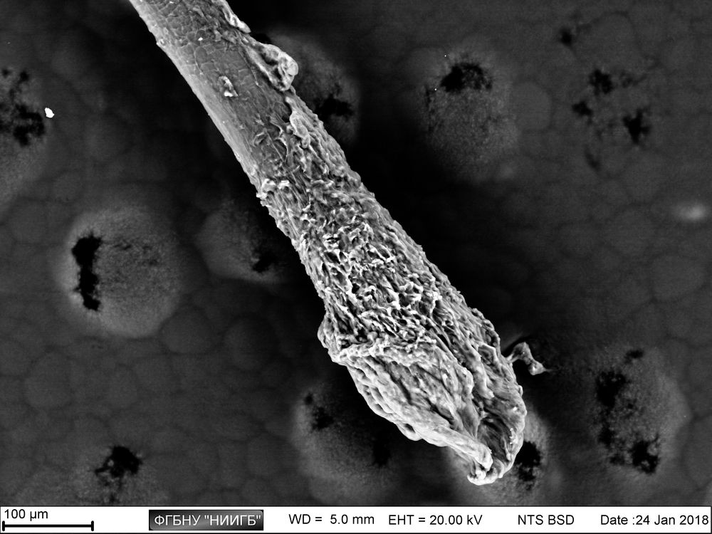 Human hair root on a carbon tape surface
(BioREE set, SEM image, BSE mode)
