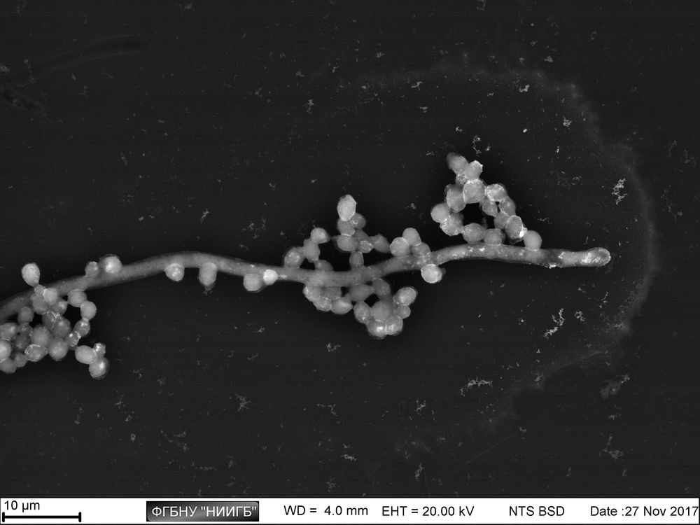 Micellar state of Candida albicans on laboratory plastic (BioREE-B set, SEM image, BSE mode)