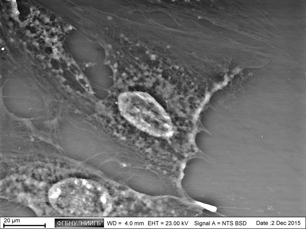 Human astrocyte culture on cultural plastic
(BioREE set, SEM image, BSE mode)