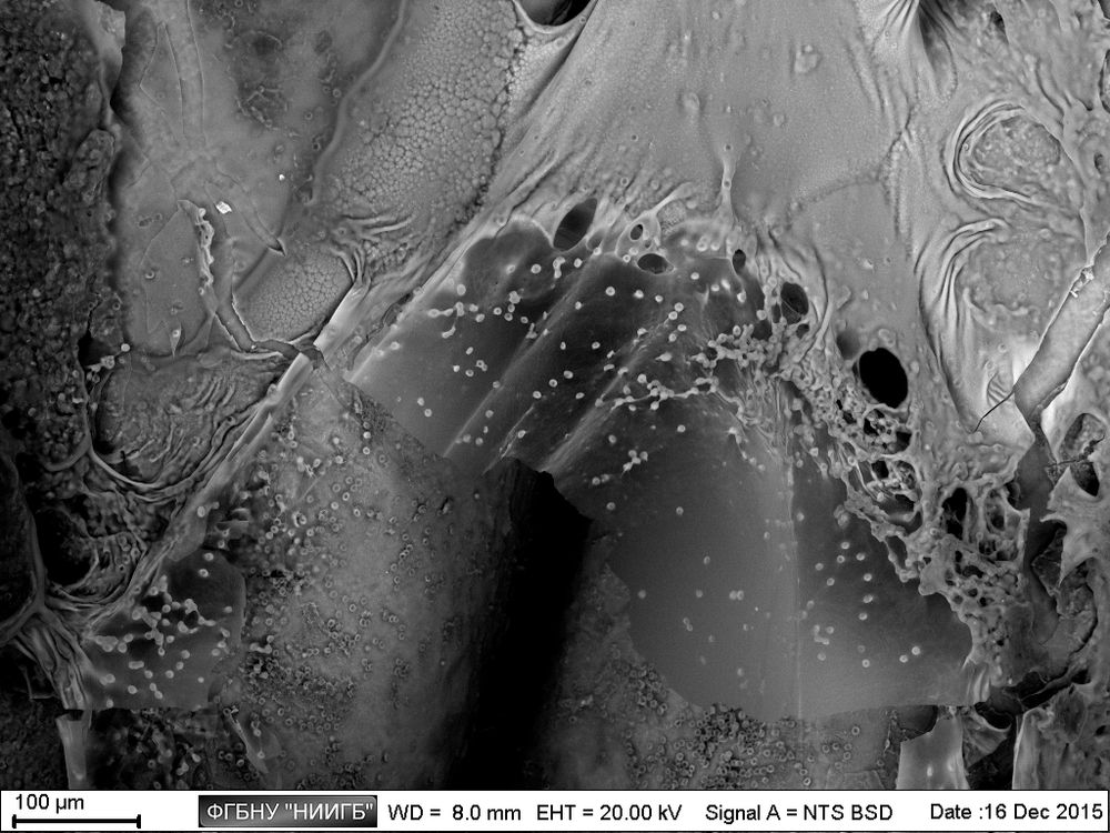 Bacterial biofilm on an explanted catheter surface 
(BioREE set, SEM image, BSE mode)