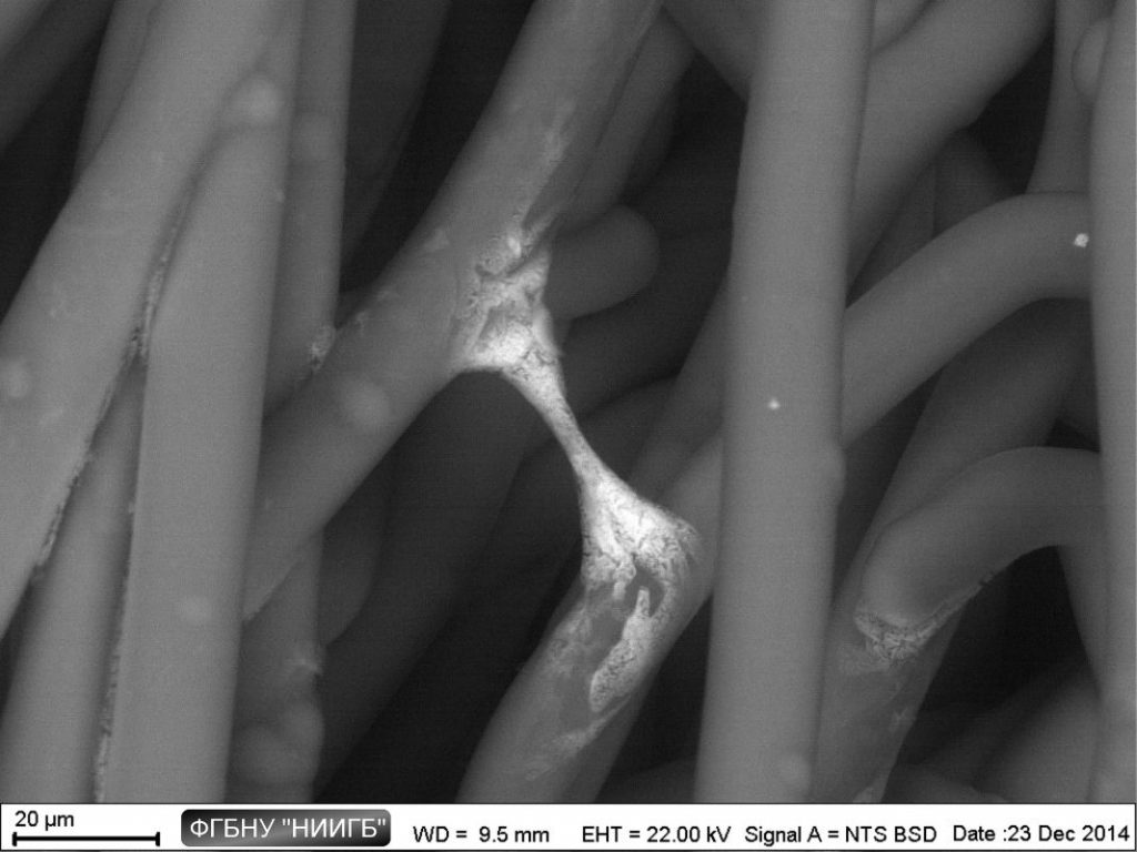 Human mesenchymal stem cells (MMSC) on carbon felt fibers
(BioREE set, SEM image, BSE mode)