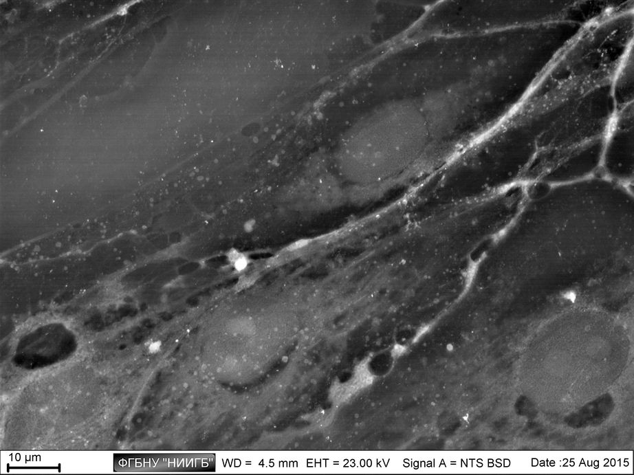 Confluent monolayer made by human limbal epithelium cell culture on cultural plastic
(BioREE set, SEM image, BSE mode)