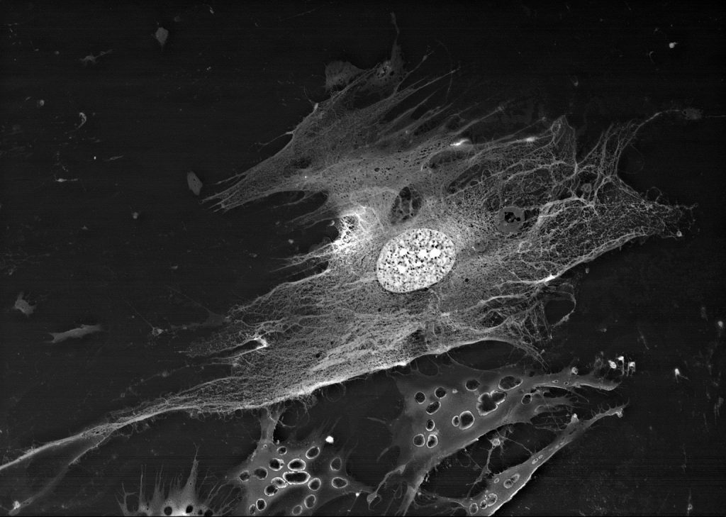 Внутренняя структура фрагмента мезенхимальной стволовой клетки (MMSC)