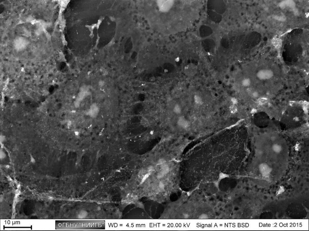 4T1 cancer cell line, breast carcinoma in mice
(BioREE set, SEM image, BSE mode)