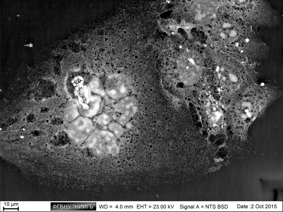 4T1 giant polynuclear tumor cell, breast carcinoma in mice
(BioREE set, SEM image, BSE mode)