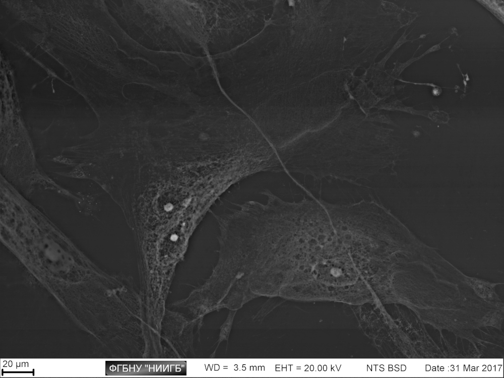 Human placenta mesenchymal stem cell (MMSC) on cultural plastic
(BioREE set, SEM image, BSE mode)