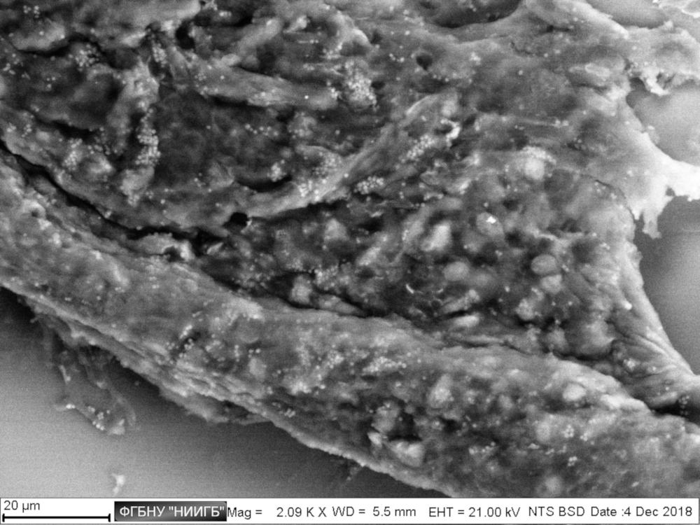 Клетки линии Pv11 (клетки эмбриональной массы личинок комара) на культуральном пластике