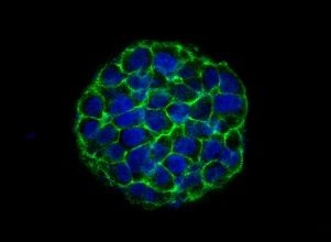3D cell cultures (spheroids) 