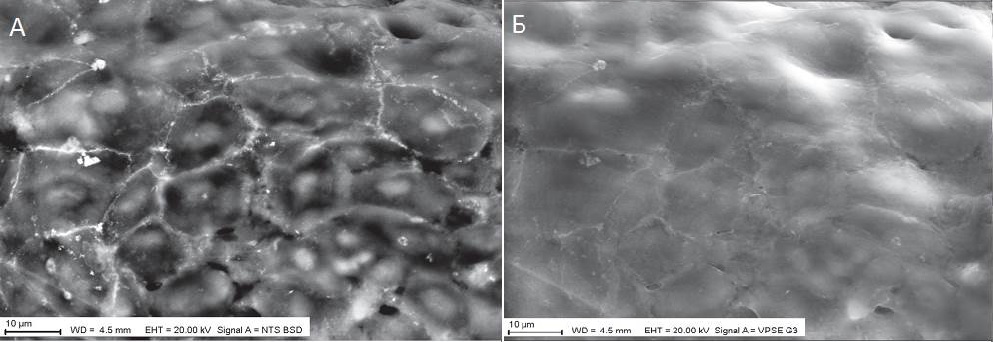 СЭМ-изображения участка поверхности роговичного эпителия после контрастирования набором BioREE